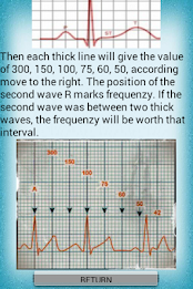 Electrocardiogram poster 5