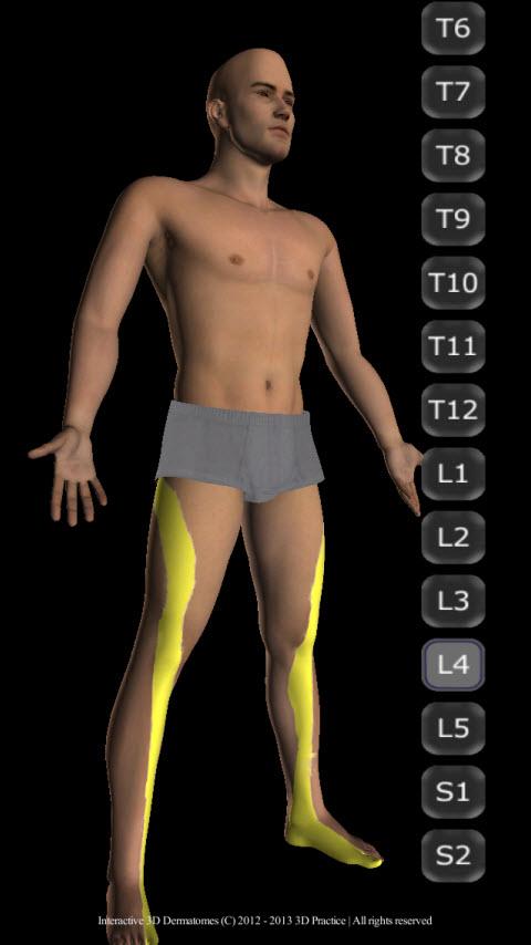 Interactive 3D Dermatomes Screen 3