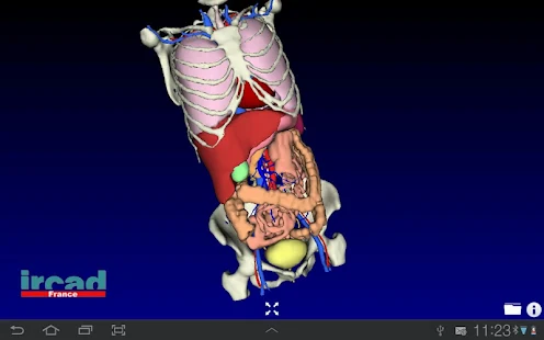 Visible Patient Lite