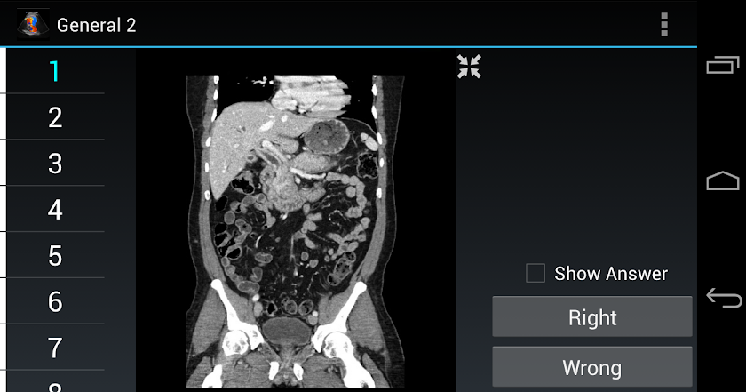 Radiology Flashcards: General2 Screen 1