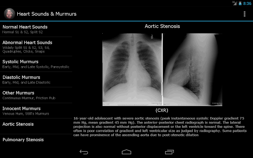 【免費醫療App】Heart Sounds & Murmurs-APP點子