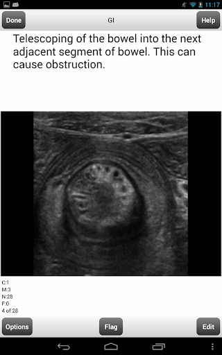 ARRT Ultrasound Flashcards