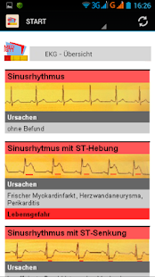 EKG-Monitoring(圖3)-速報App