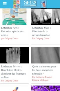 How to download Endodontie SFE lastet apk for pc