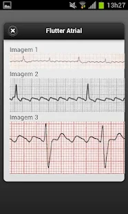 免費下載醫療APP|ECG app開箱文|APP開箱王