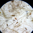 Microplankton Biogeography
