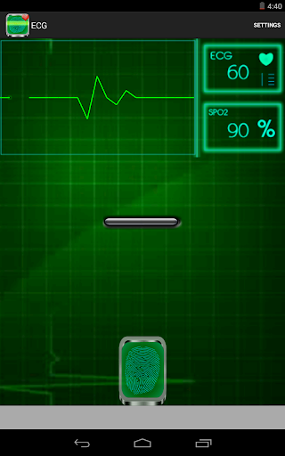 ECG Monitor and Report Prank