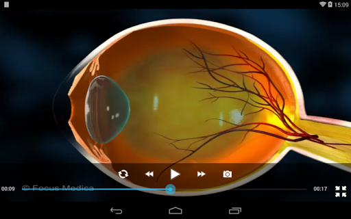 免費下載醫療APP|Glaucoma-An Overview app開箱文|APP開箱王