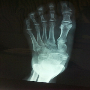 Xray Scanner.apk 1.1