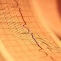 EKG: Advanced