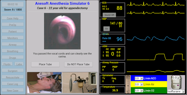 Anesthesia Sim 6(圖3)-速報App