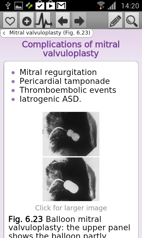Oxford Handbook Cardiology 2 E Screen 3