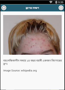 Lastest ব্রণ (Acne) ব্রণের সহজ চিকিৎসা APK for Android