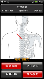 穴位测验(圖3)-速報App