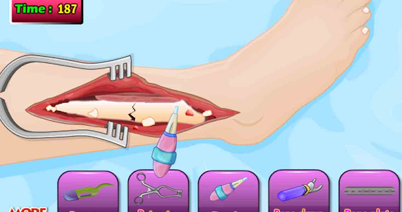 download Dokter Tom Leg Bedah Permainan free