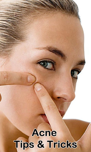 Acne Free Tips and Tricks