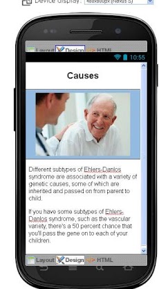 Ehlers Danlos Syndrome Diseaseのおすすめ画像4