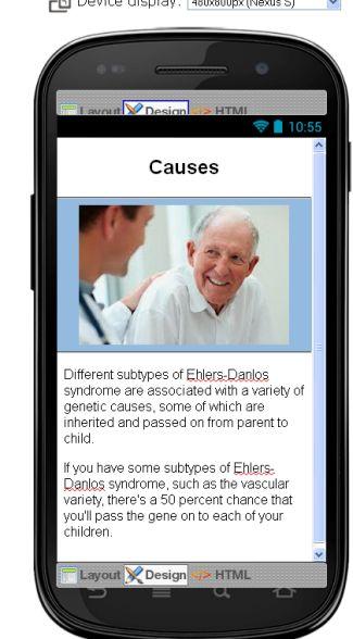 Ehlers Danlos Syndrome Diseaseのおすすめ画像4
