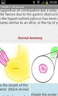 Pediatric Ultrasound Screenshots 6