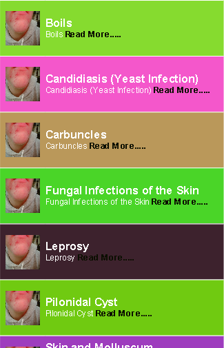 Skin Infections Guides