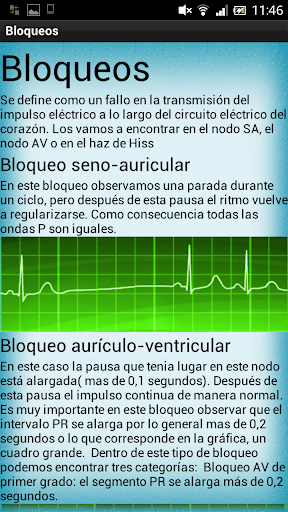 【免費醫療App】Electrocardiograma-APP點子