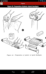 Bandaging and Splinting Screenshots 23