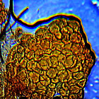 Common Jellyspot- Spores