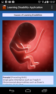 How to download Learning Disability App 1.0 mod apk for laptop