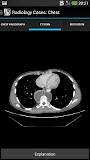 Radiology Cases: Chest