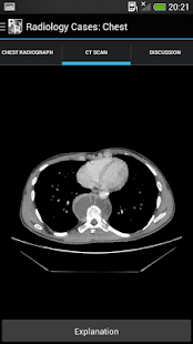 Radiology Cases: Chest(圖1)-速報App
