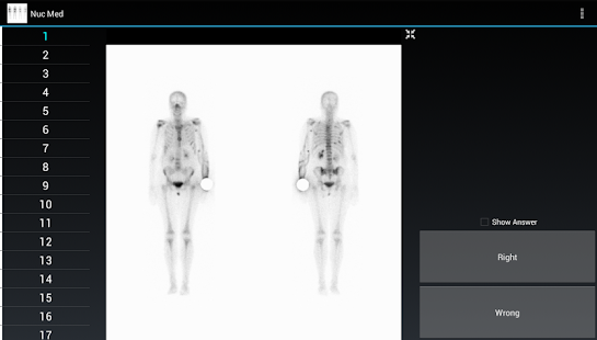 How to install Radiology Flashcards: Nuc Med patch 1.4 apk for bluestacks