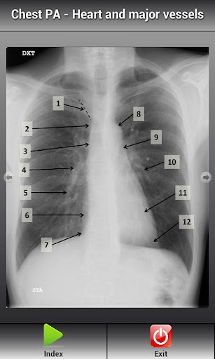 【免費教育App】Human X-ray Anatomy-APP點子