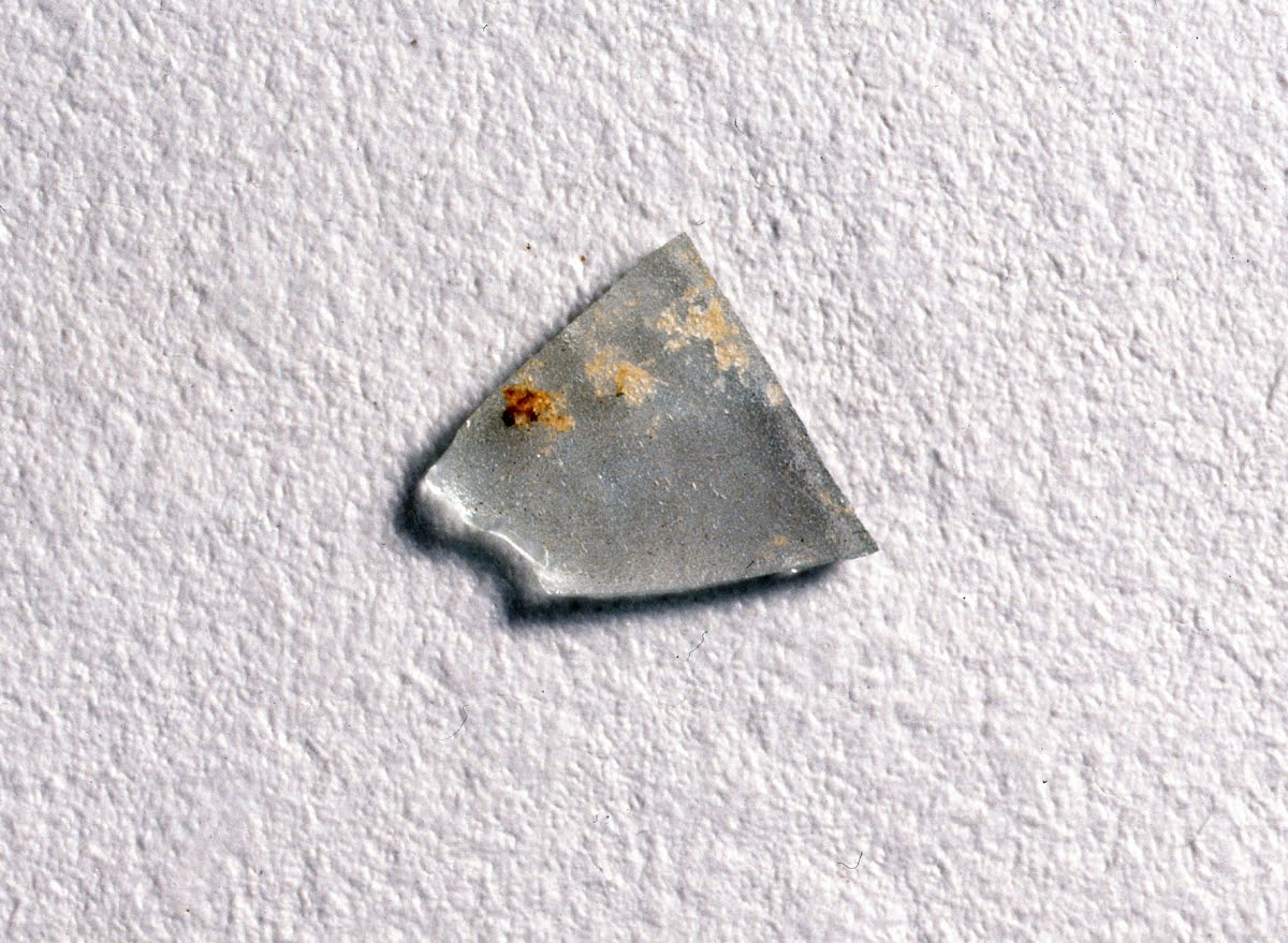 体内から取り出されたガラス片 Google Arts Culture