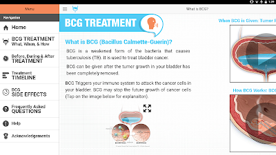 Get Bladder Cancer Prognosis And Treatment PNG