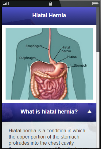 Hiatal Hernia Symptoms - Diet