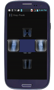 Xray- Prank Screenshots 4
