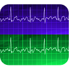 Electrocardiogram