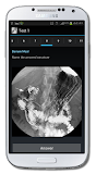 Radiological Anatomy For FRCR1