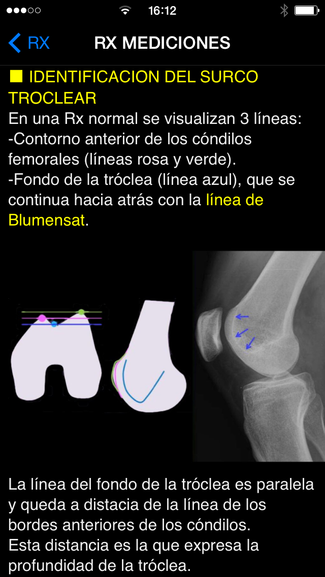Rodilla App Screen 3