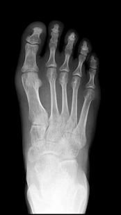 X-ray Body Scanner Prank Screenshots 4