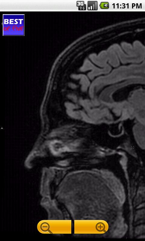 NeuroRadiology - Brain Screen 3