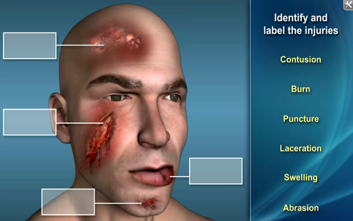 【免費教育App】Medrills 2nd Assessment Trauma-APP點子