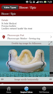Free Download ViV Aortic APK for Android