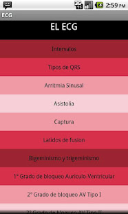 Electrocardiograma ECG Tipos(圖1)-速報App